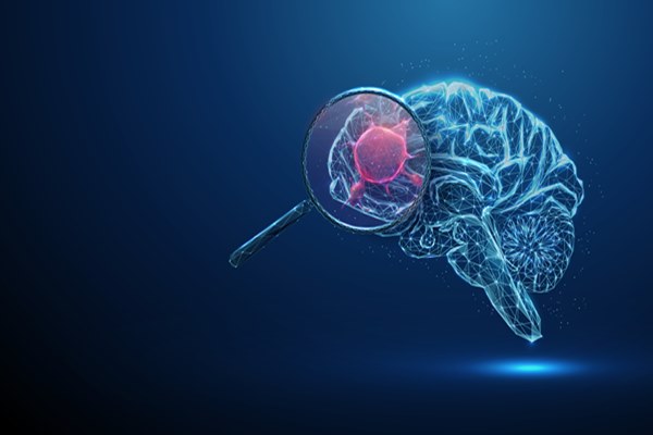 Blood Test Enables Monitoring of Hard to Diagnose Brain Diseases by Detecting Brain Cell Specific Signals