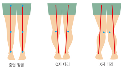 이너멜 이미지