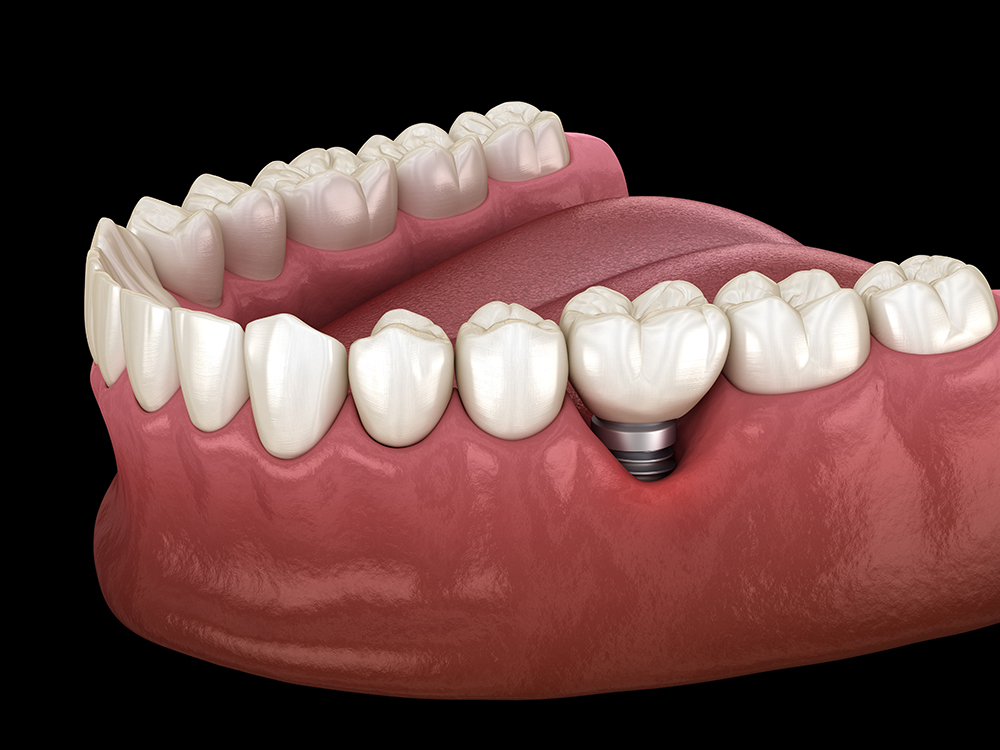 Before Image